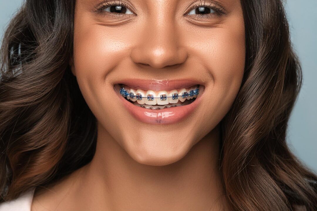 underbite treatment near me
