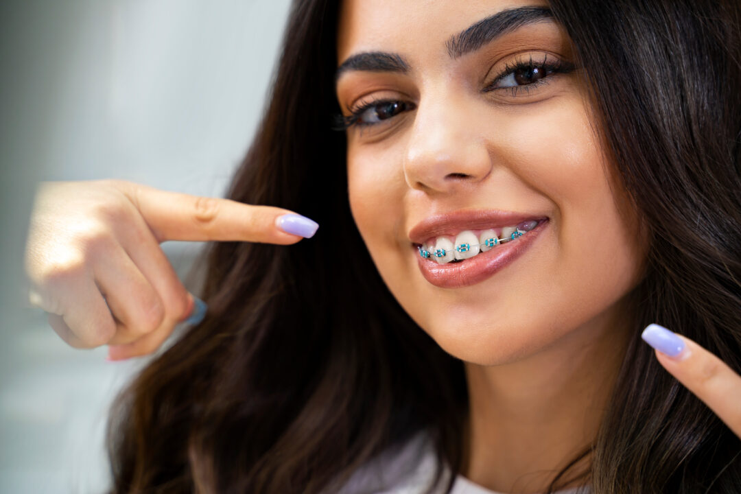braces orthodontist near me