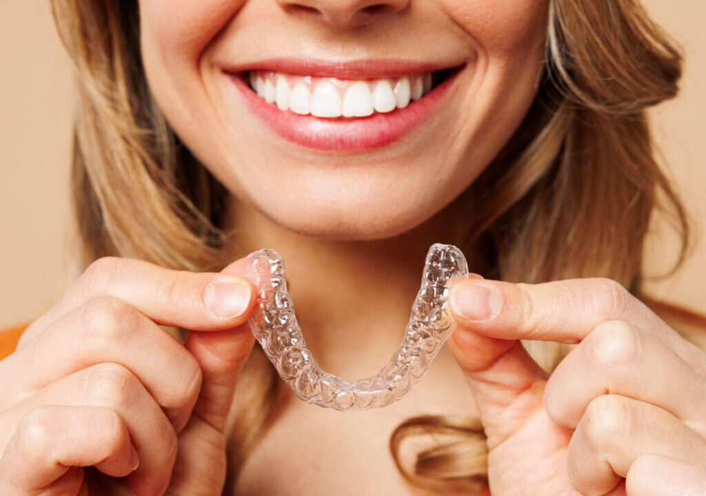 Invisalign Roanoke