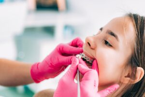 braces orthodontist near me